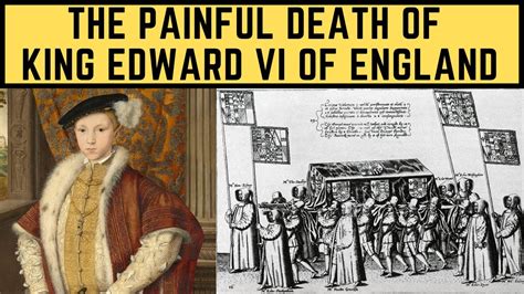 how did king edward die